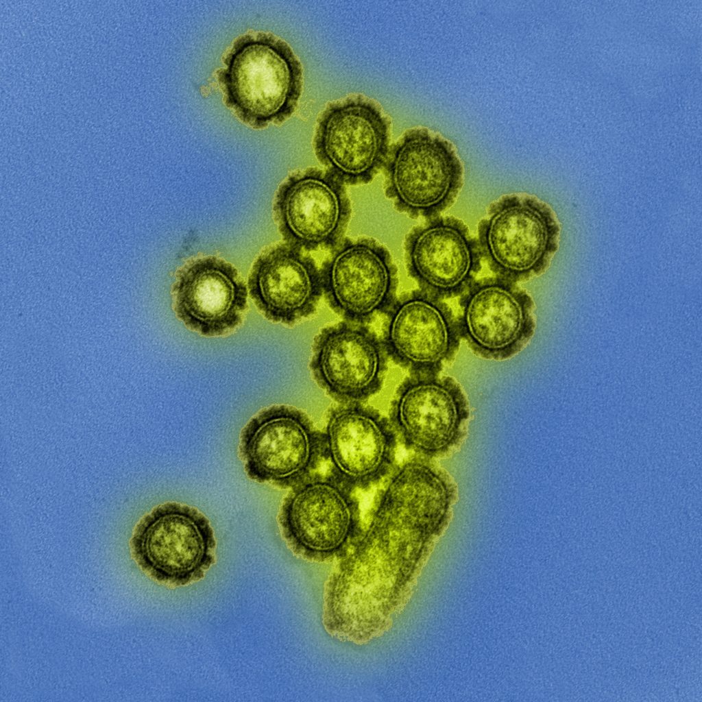 Influenza H1N1 7 Influenza A H1N1 Viral Particles