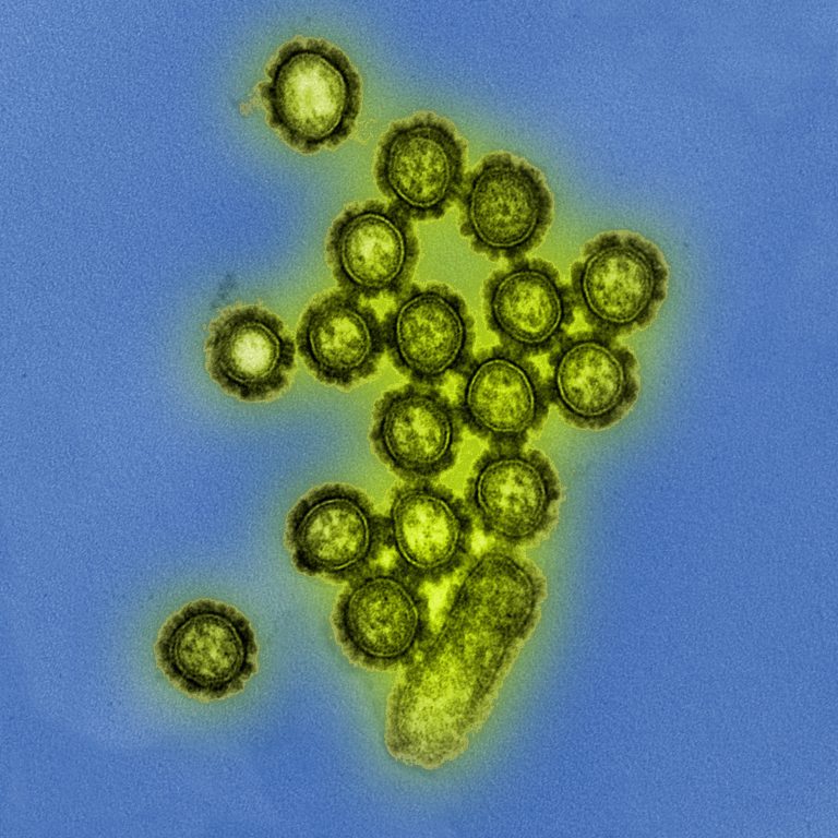Influenza A H1N1 Viral Particles
