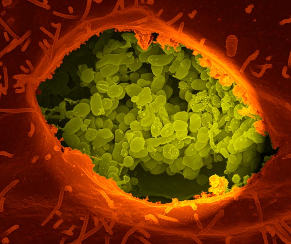 Coxiella burnetti growing in the vacuole of an infected cell.