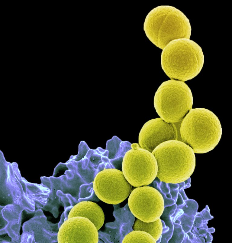 MRSA colonies in chains attached to an epithelial cell.
