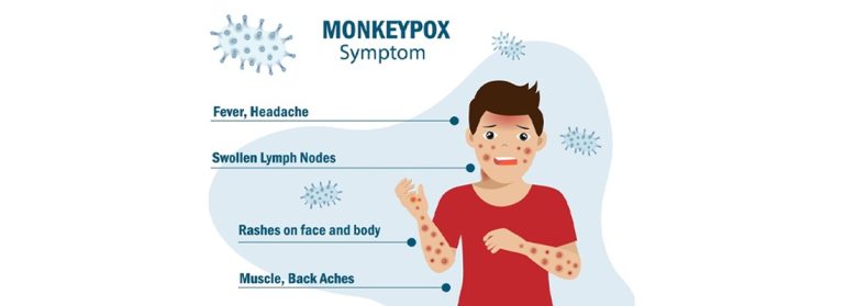 Monkeypox goes global: Why scientists are on alert