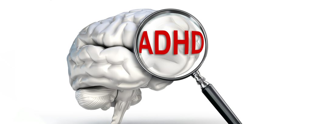 Developmental Risk Factors for ADHD include (Austerman, 2015)